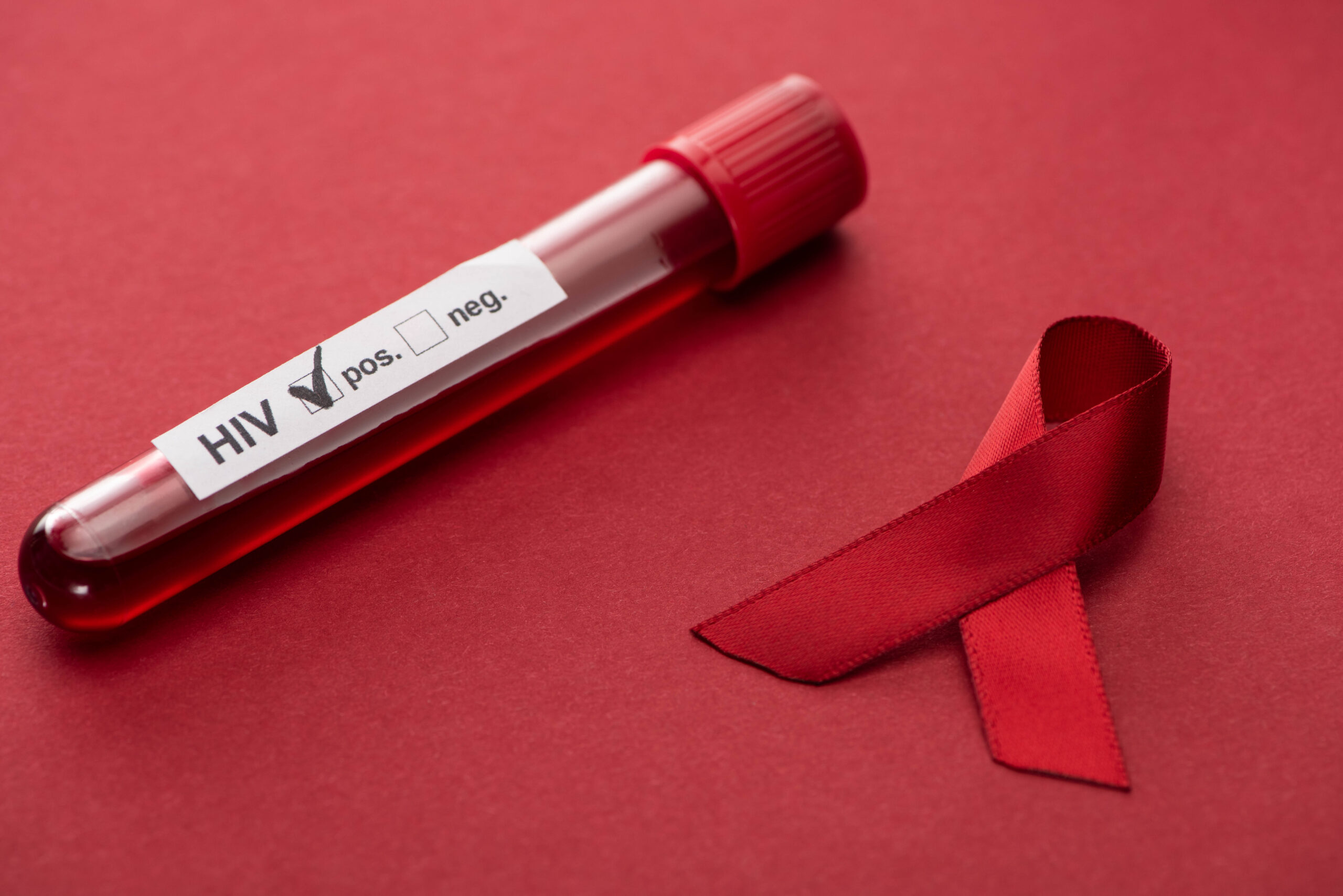 HIV PREVENTION